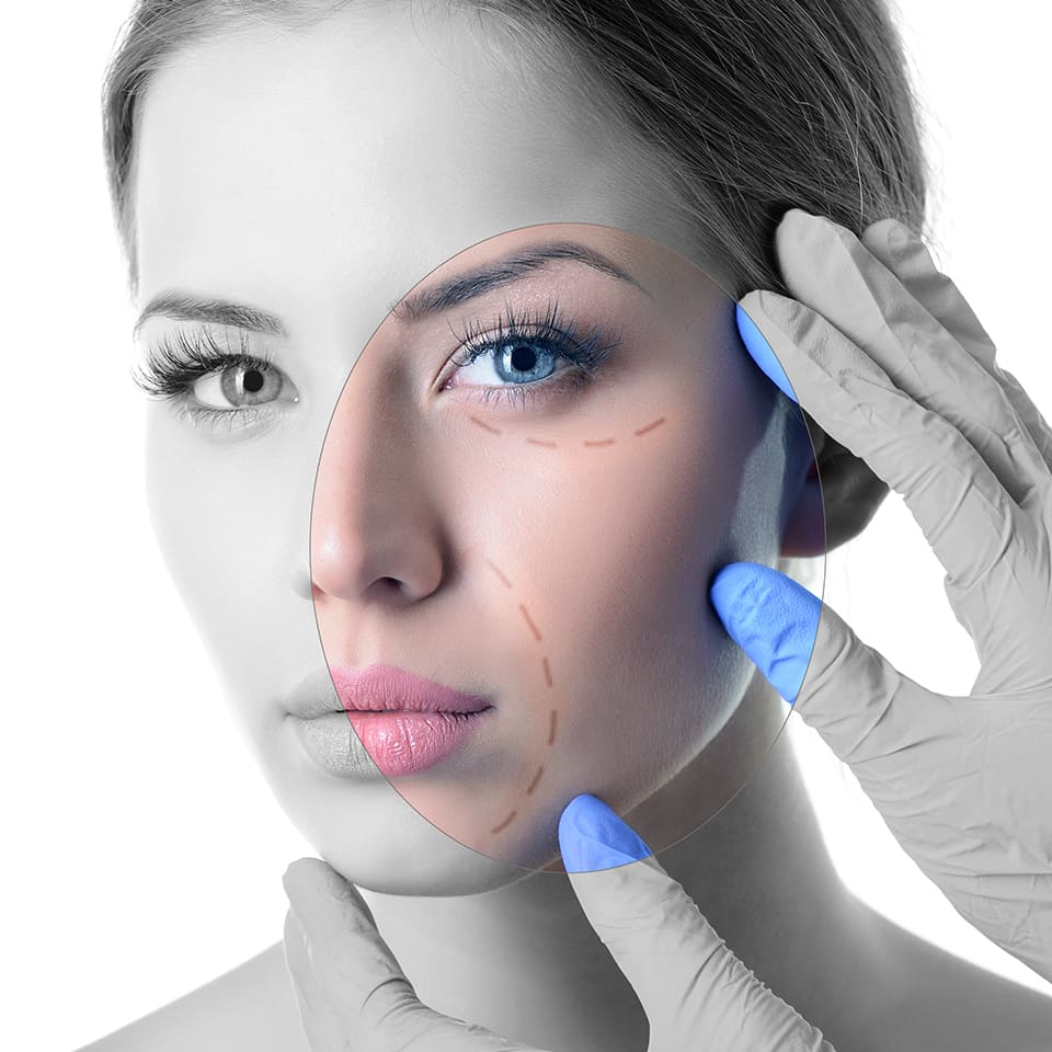 Lifting Facial (facelift) - Dr. Nadir Salaues - Plastic Surgeon in Santa  Cruz