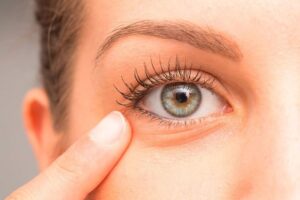 Read more about the article In which cases is the operation of eye bags necessary??